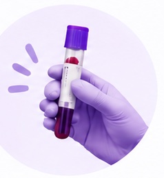 A gloved hand holding a blood sample tube.